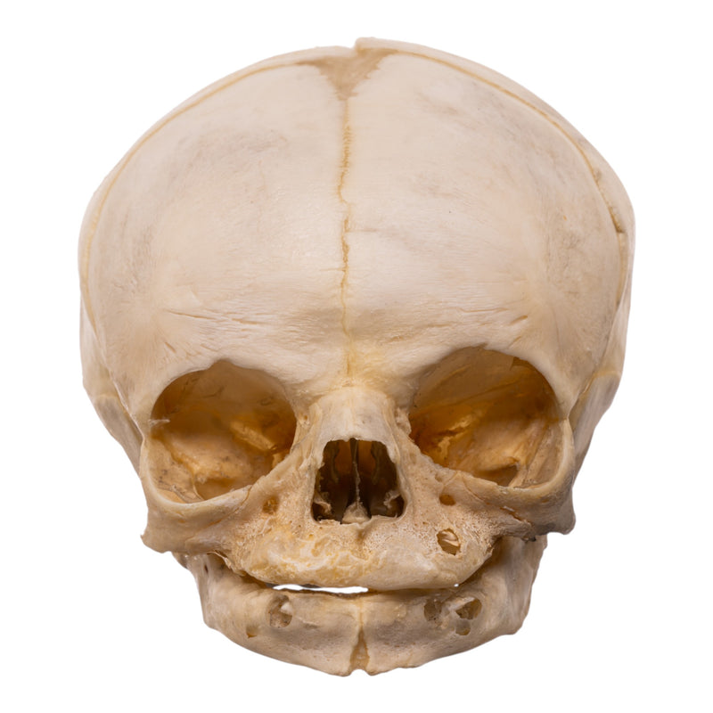 Real Human Fetal Skull