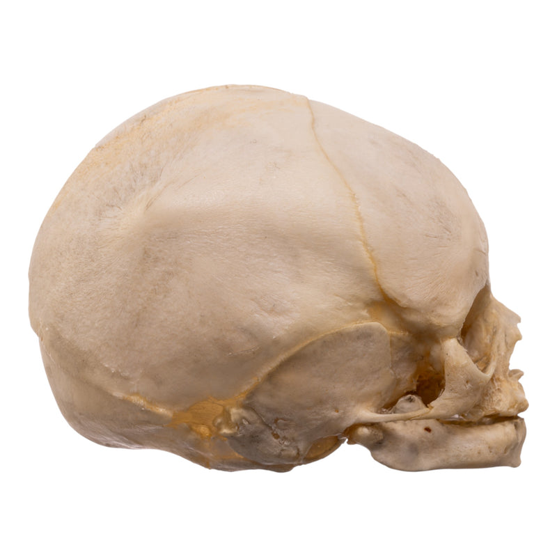Real Human Fetal Skull
