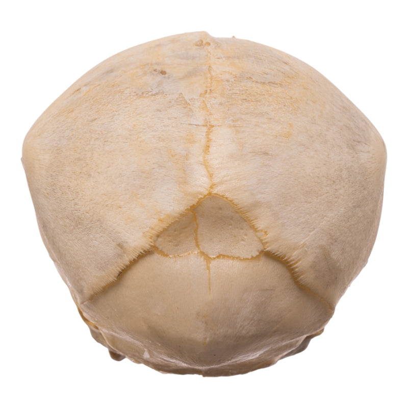 Real Human Fetal Skull
