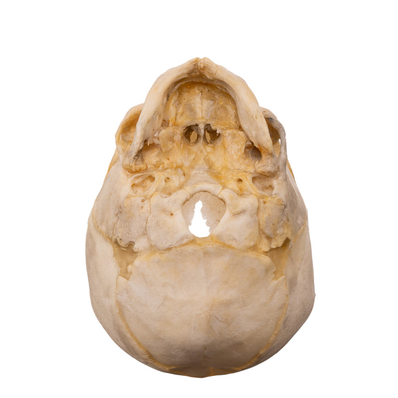 Real Human Fetal Skull