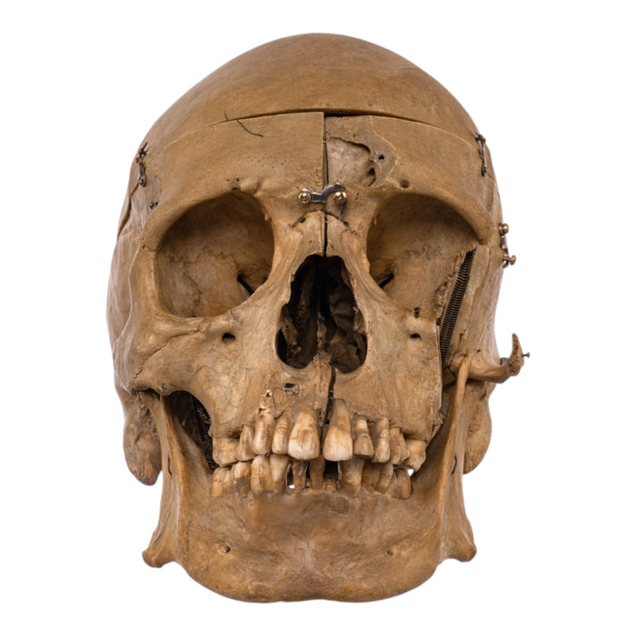 Real Human Skull - Dissected