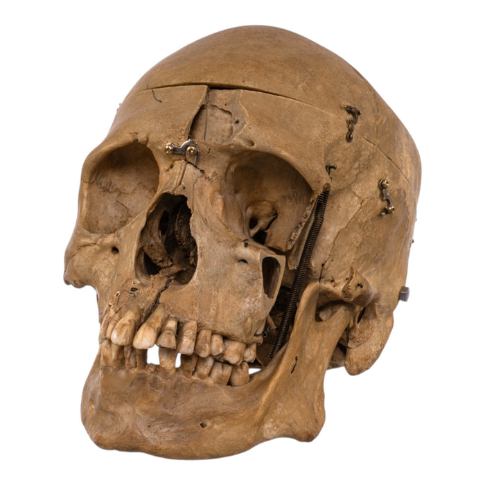 Real Human Skull - Dissected
