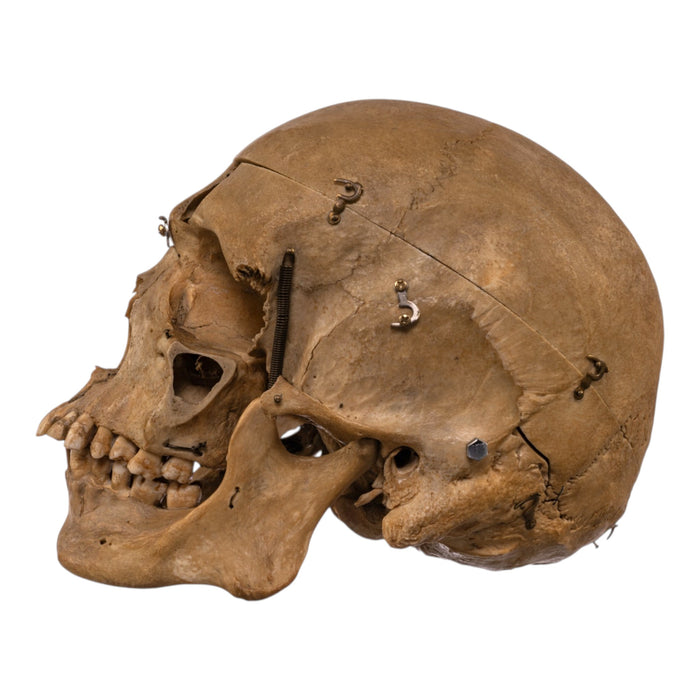 Real Human Skull - Dissected
