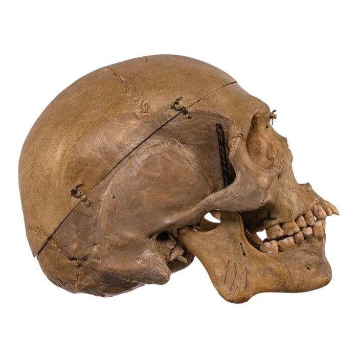 Real Human Skull - Dissected