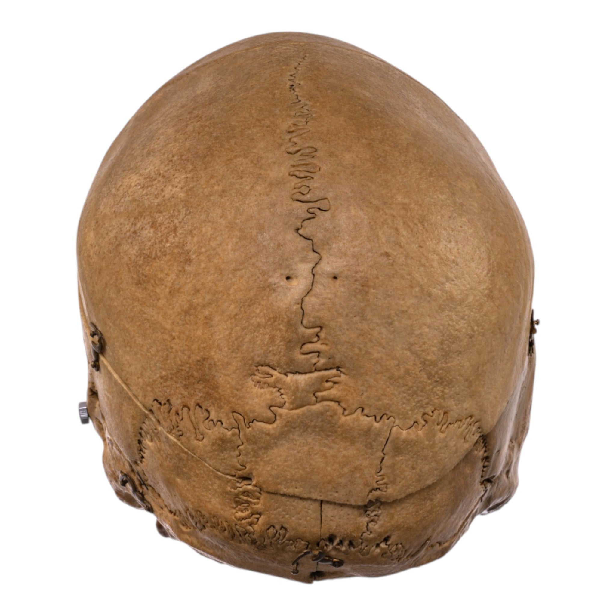 Real Human Skull - Dissected For Sale — Skulls Unlimited