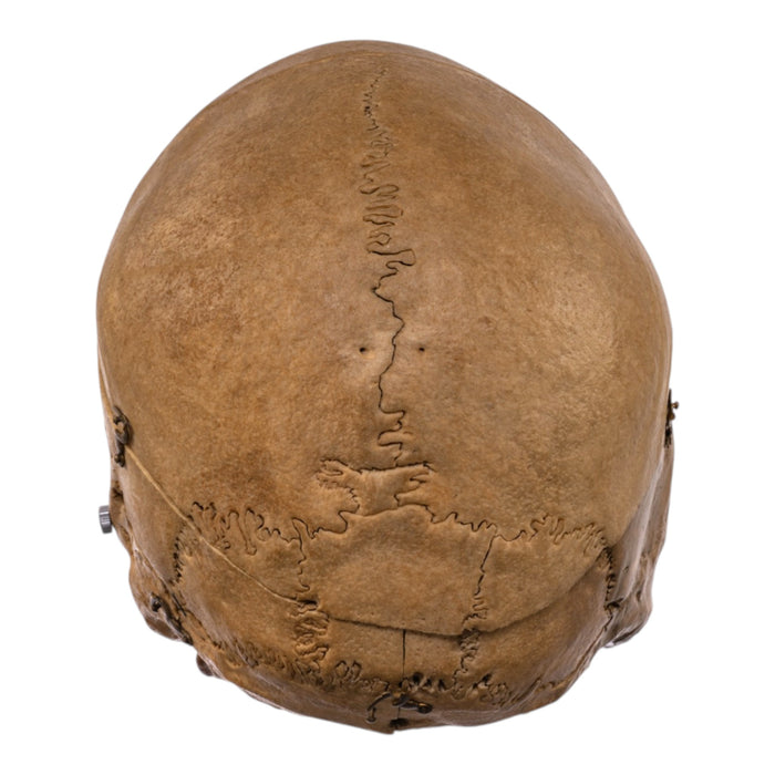 Real Human Skull - Dissected