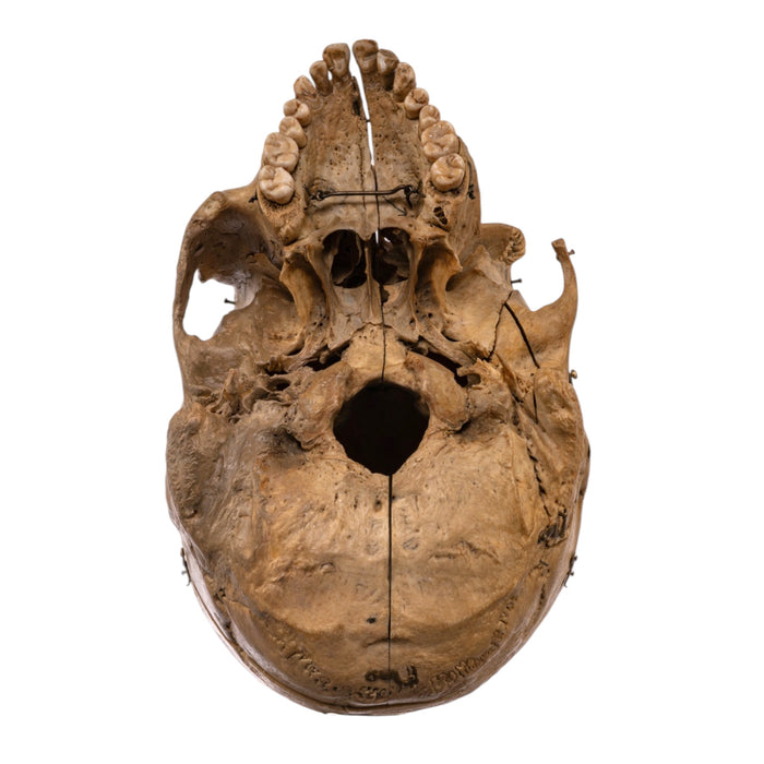 Real Human Skull - Dissected