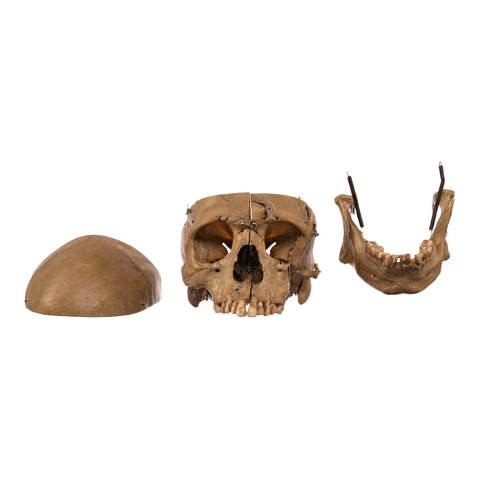Real Human Skull - Dissected