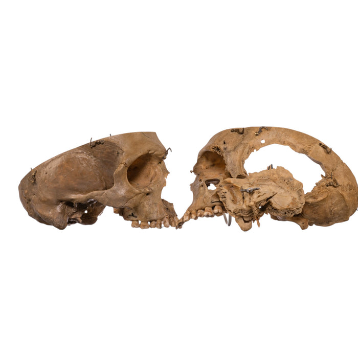 Real Human Skull - Dissected
