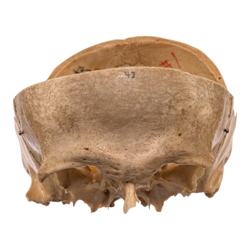 Real Human Partial Skull