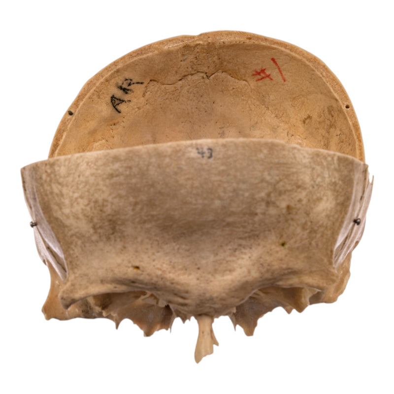 Real Human Partial Skull