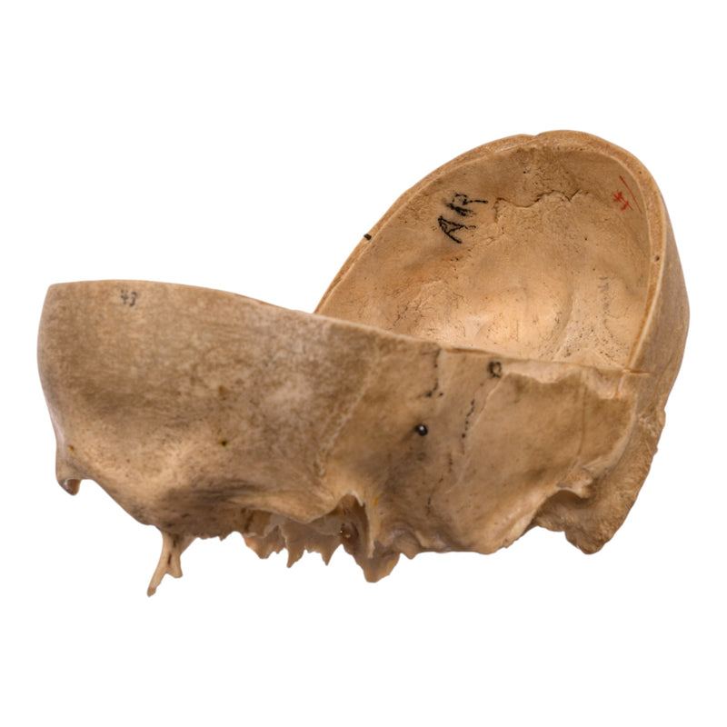 Real Human Partial Skull