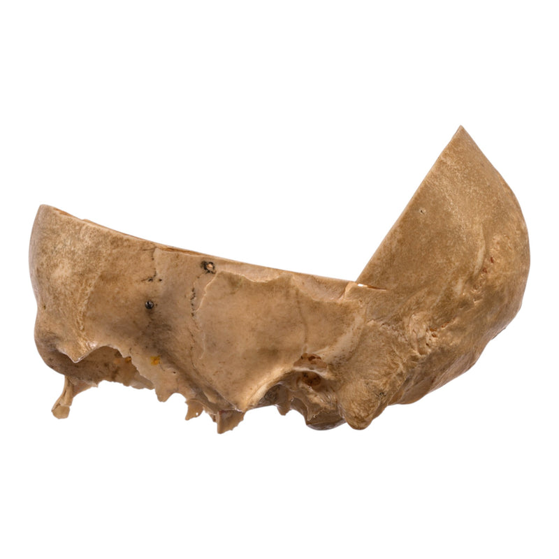 Real Human Partial Skull