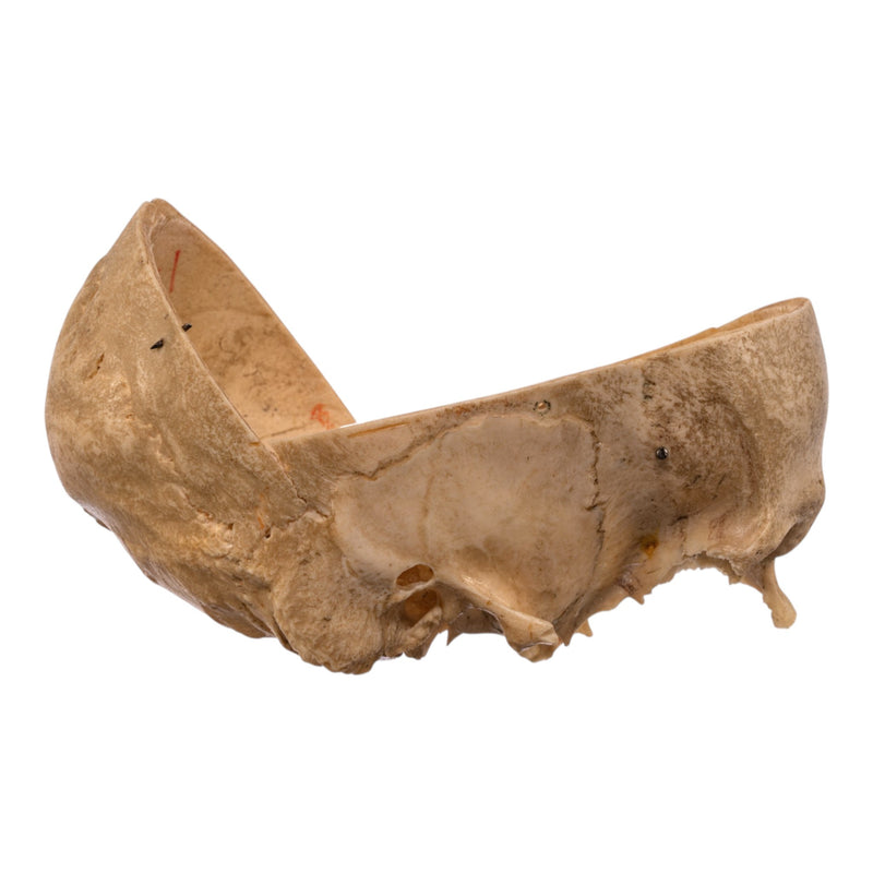 Real Human Partial Skull