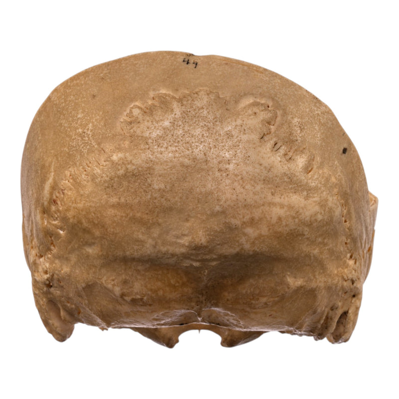 Real Human Partial Skull
