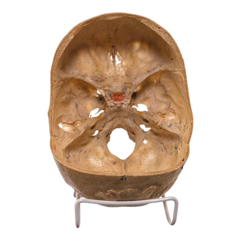 Real Human Partial Skull