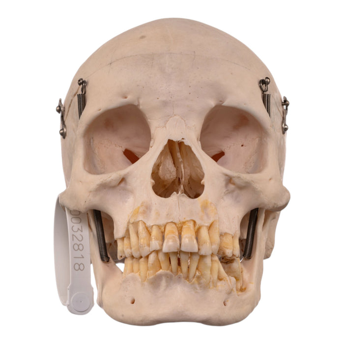 Real Human Skull