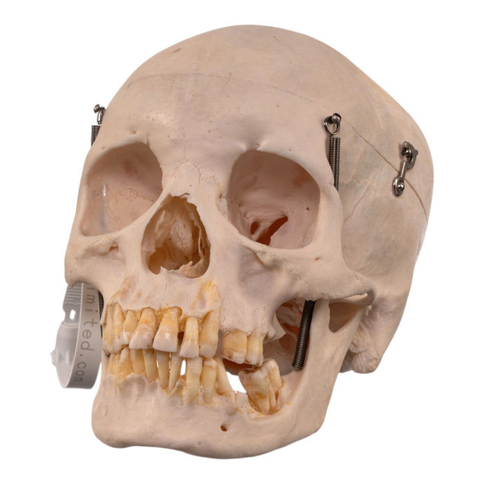 Real Human Skull