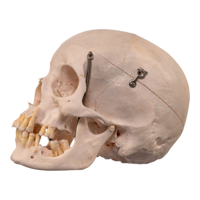 Real Human Skull