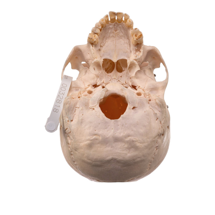 Real Human Skull