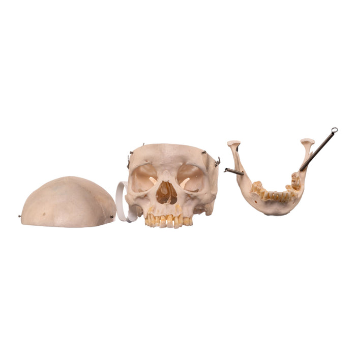 Real Human Skull