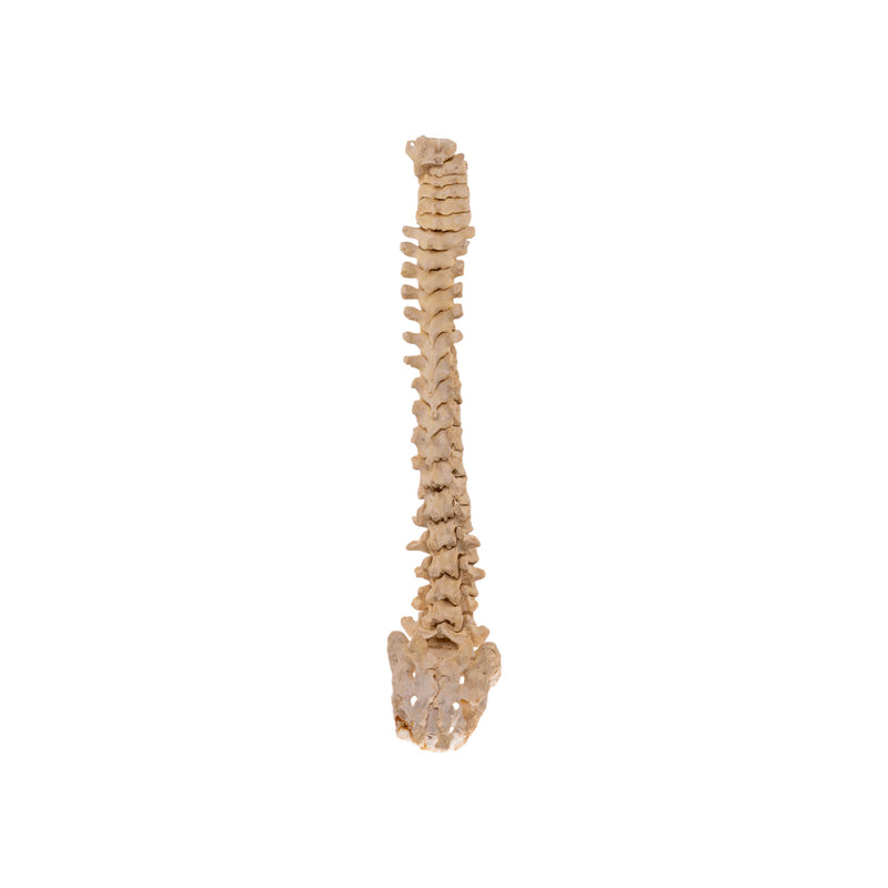 Real Human Spine and Sacrum