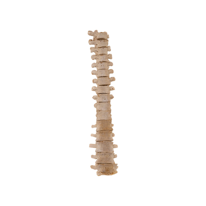 Real Loosely Strung Human Spine - Partial