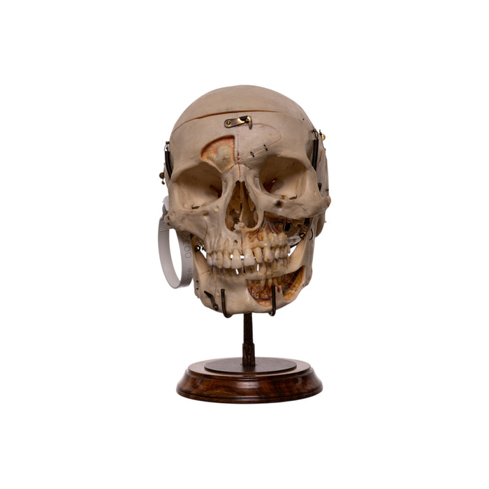 Real Human Skull - Dissected - With Stand