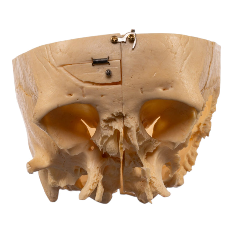 Real Human Partial Skull - Dissected
