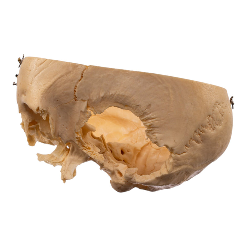 Real Human Partial Skull - Dissected