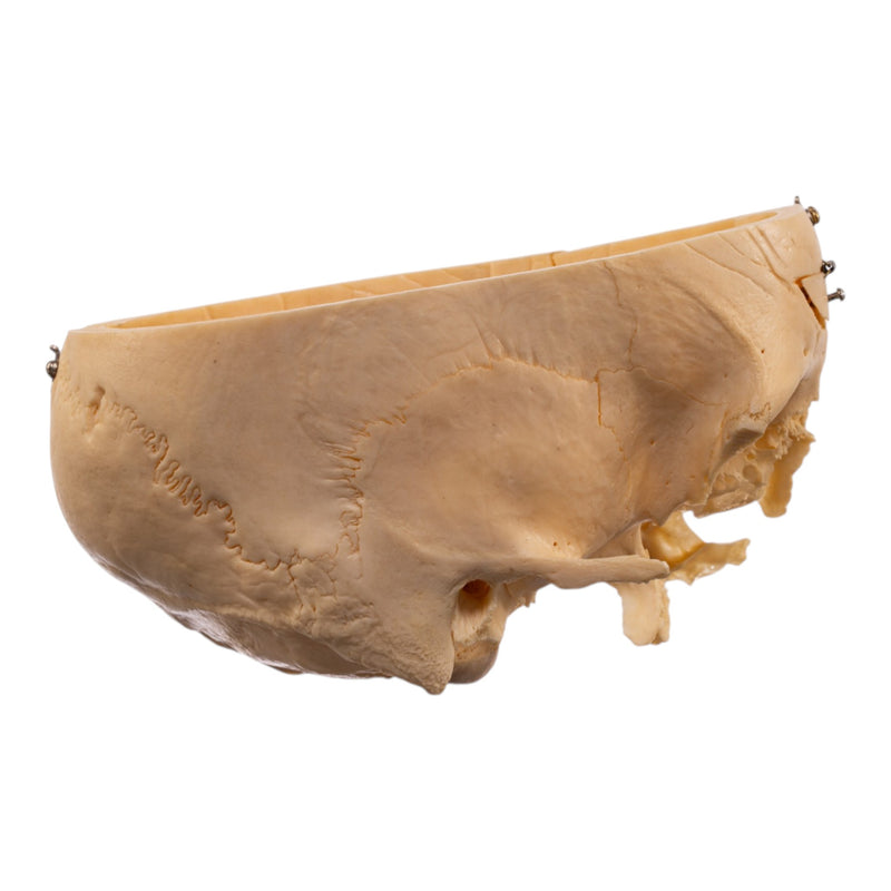Real Human Partial Skull - Dissected