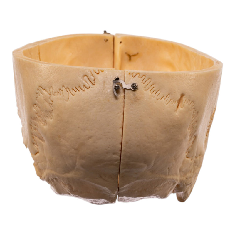 Real Human Partial Skull - Dissected