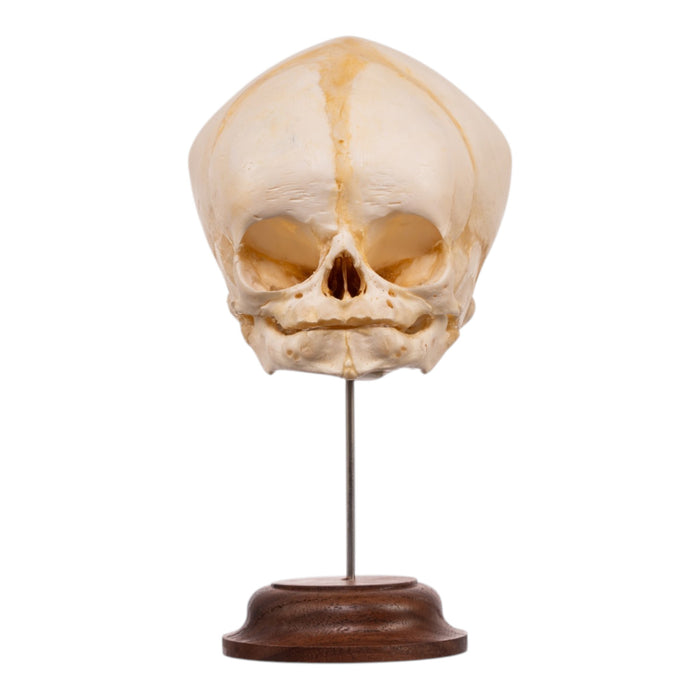 Real Fetal Human Skull on Stand
