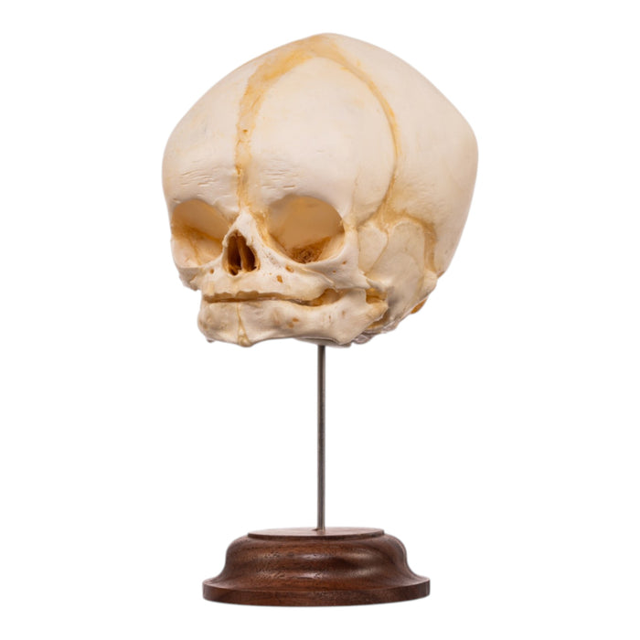 Real Fetal Human Skull on Stand