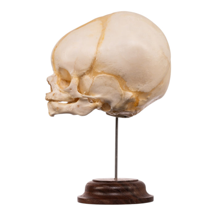 Real Fetal Human Skull on Stand
