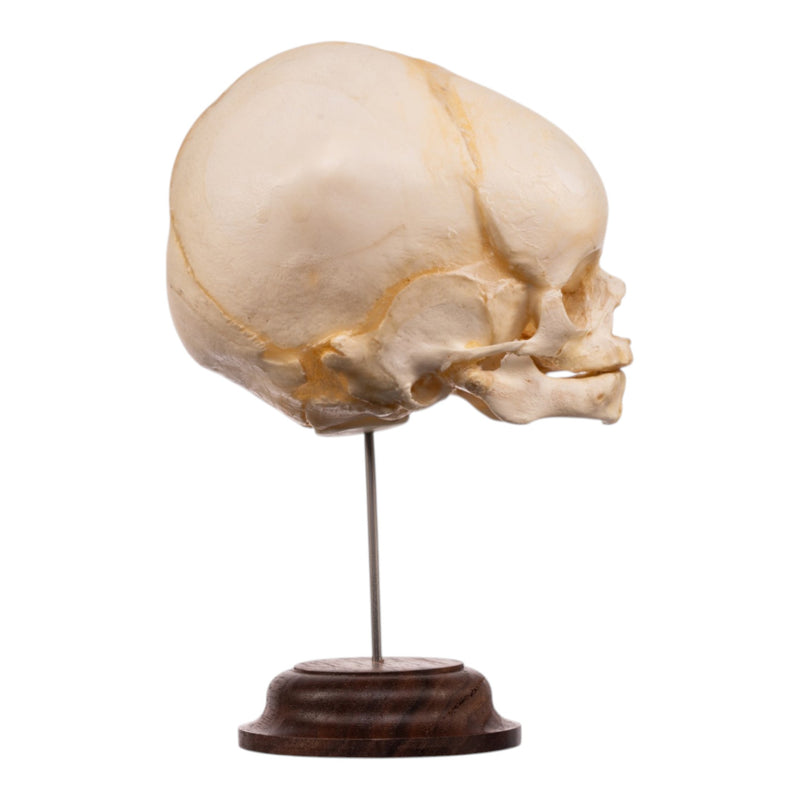 Real Fetal Human Skull on Stand