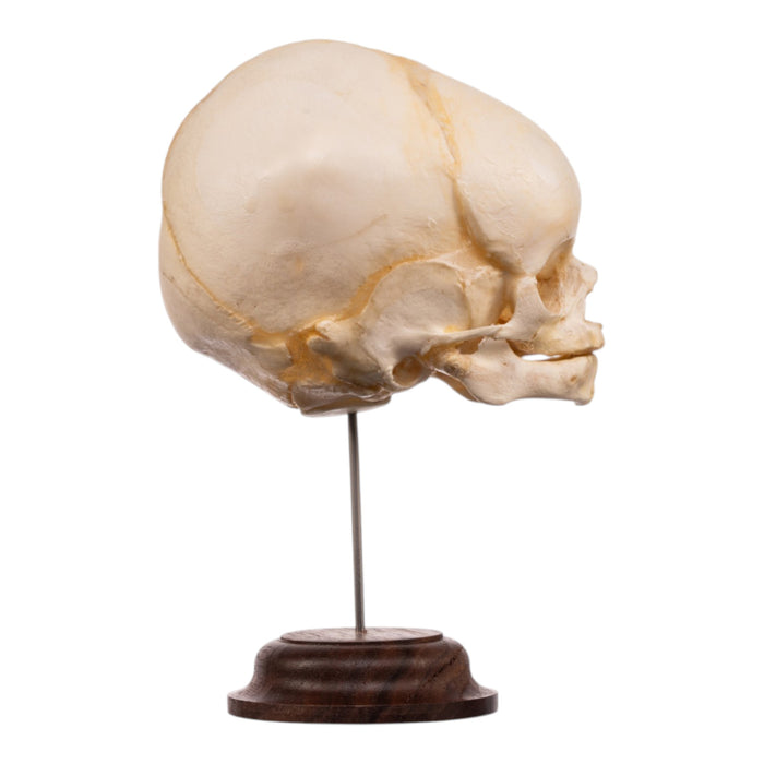 Real Fetal Human Skull on Stand