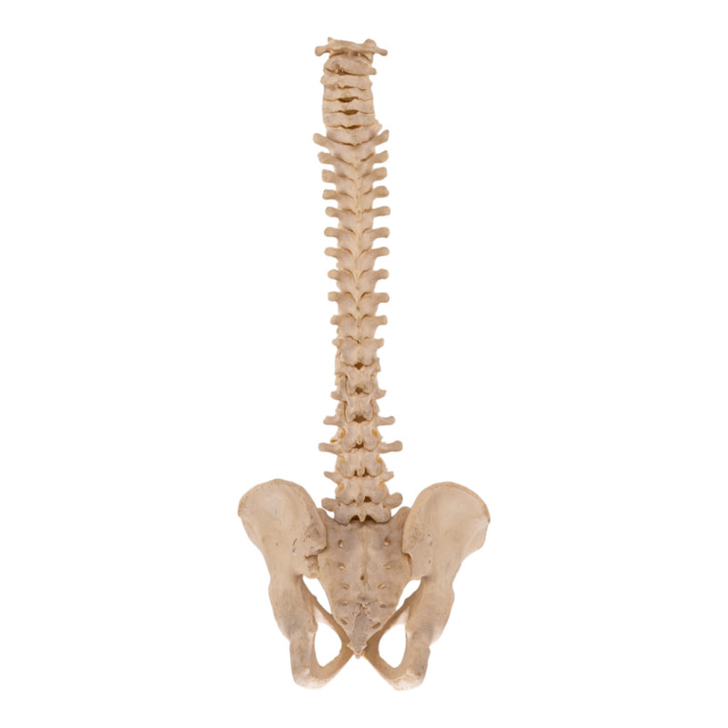 Real Human Spine and Pelvis