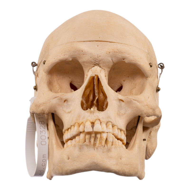 Real Human Skeleton - Disarticulated