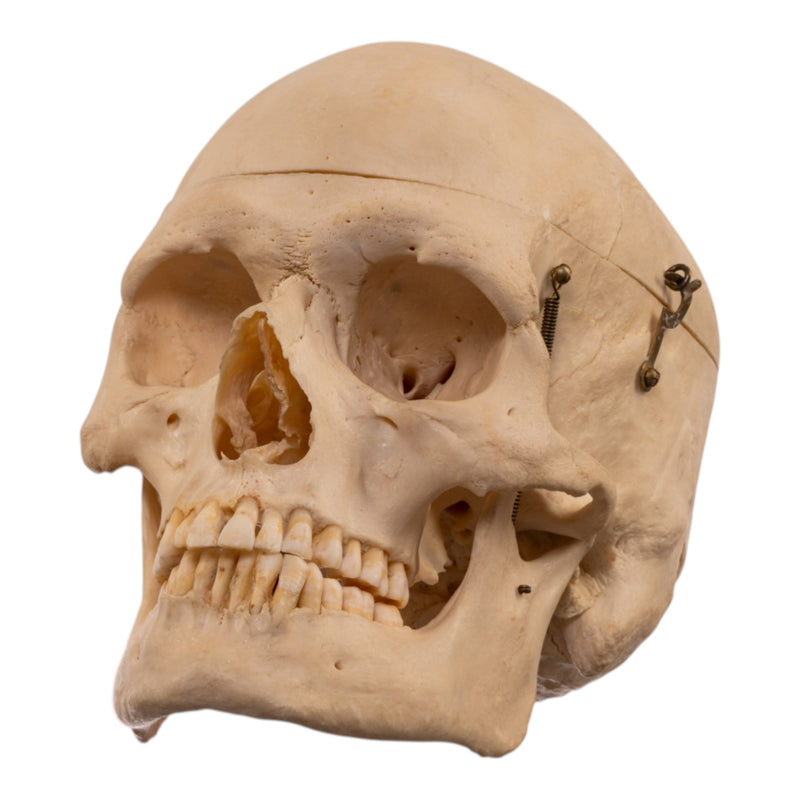 Real Human Skeleton - Disarticulated