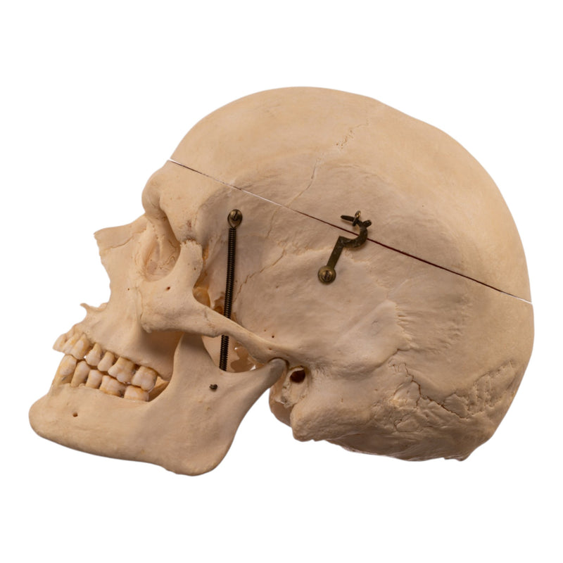 Real Human Skeleton - Disarticulated