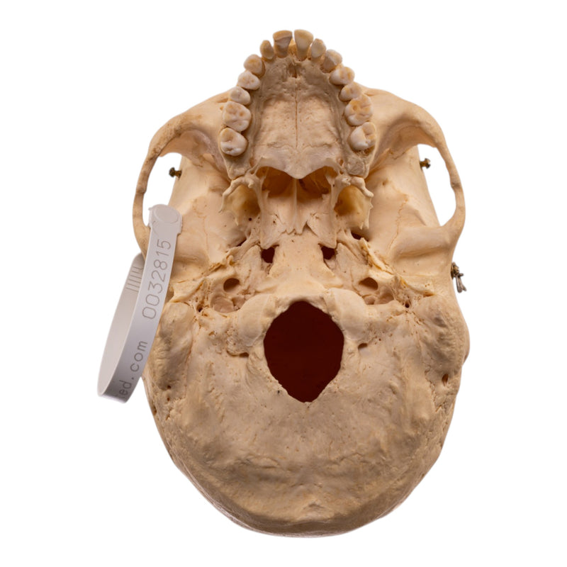 Real Human Skeleton - Disarticulated