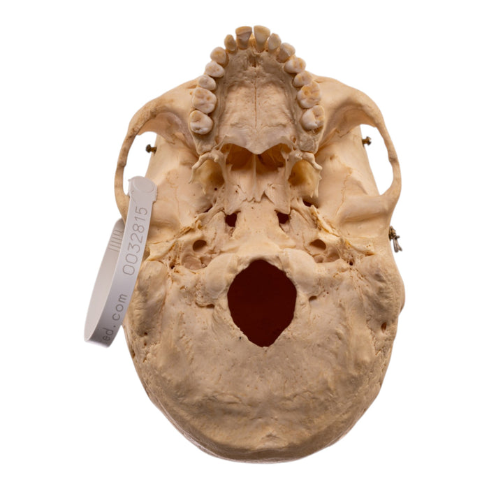 Real Human Skeleton - Disarticulated