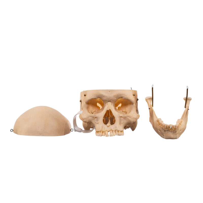 Real Human Skeleton - Disarticulated