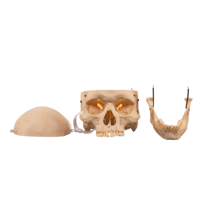 Real Human Skeleton - Disarticulated
