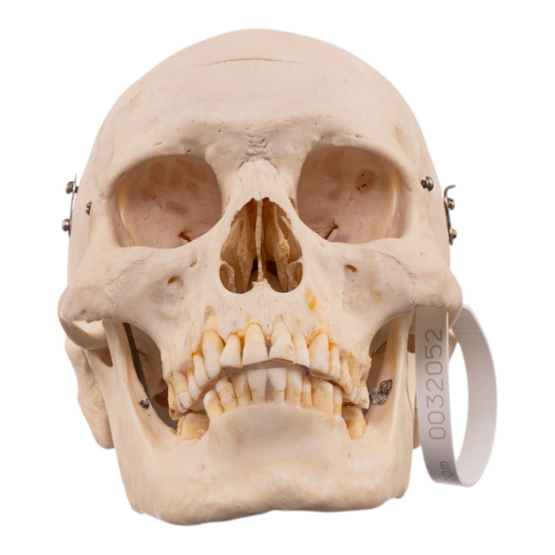 Real Human Half Skeleton