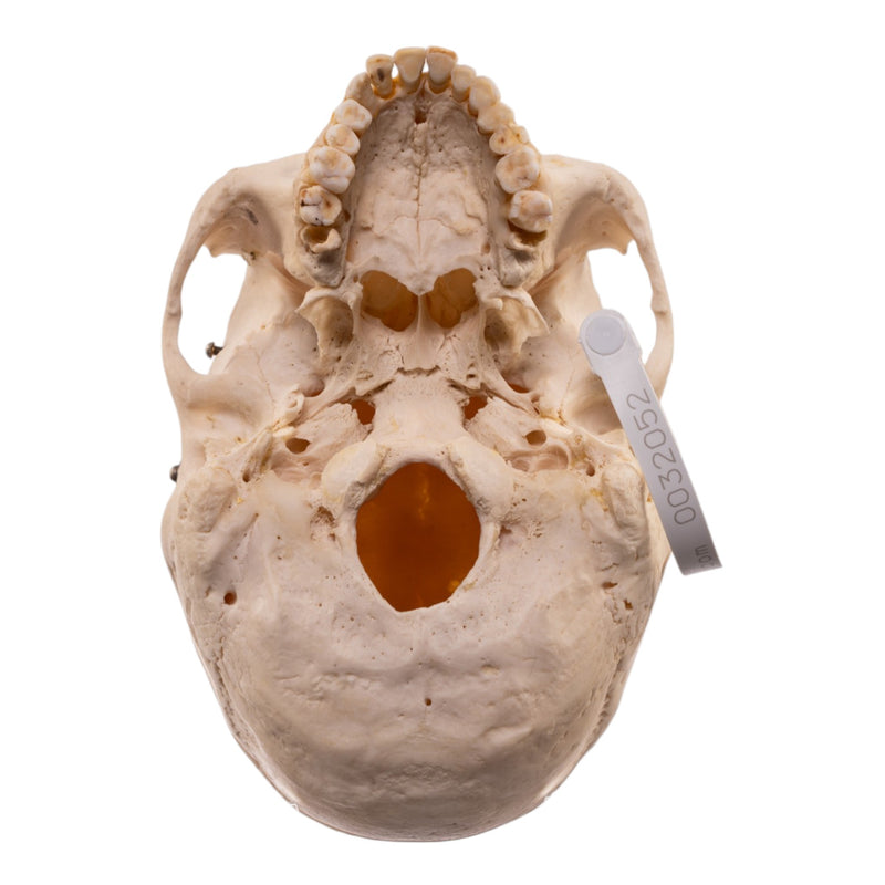 Real Human Half Skeleton