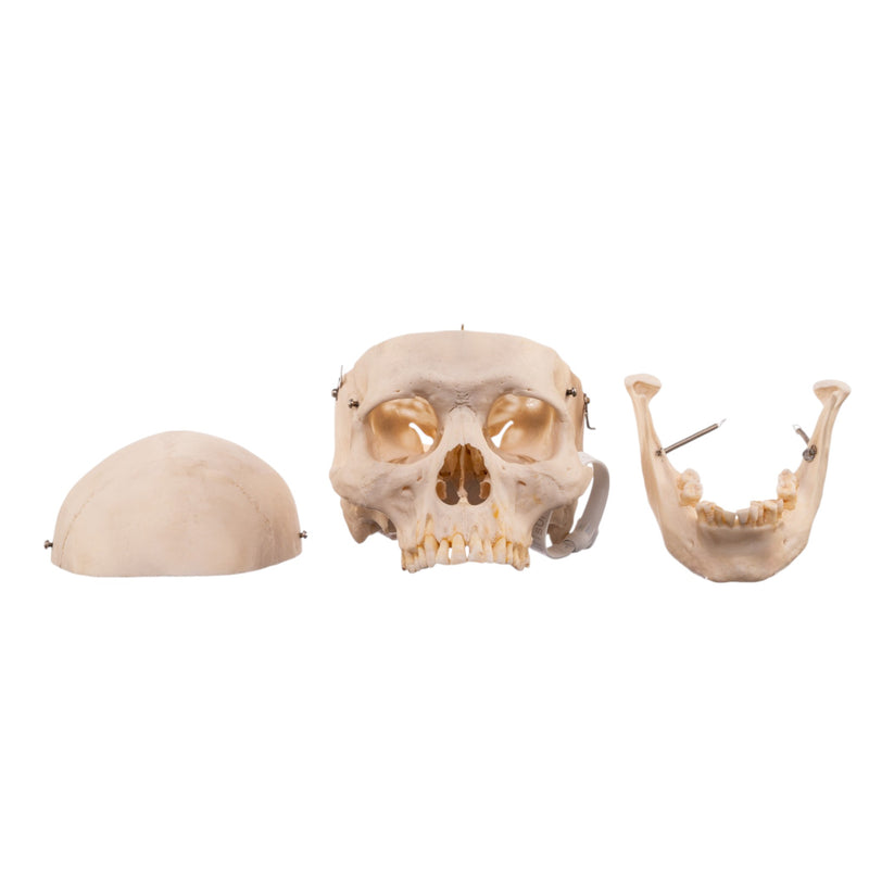 Real Human Half Skeleton