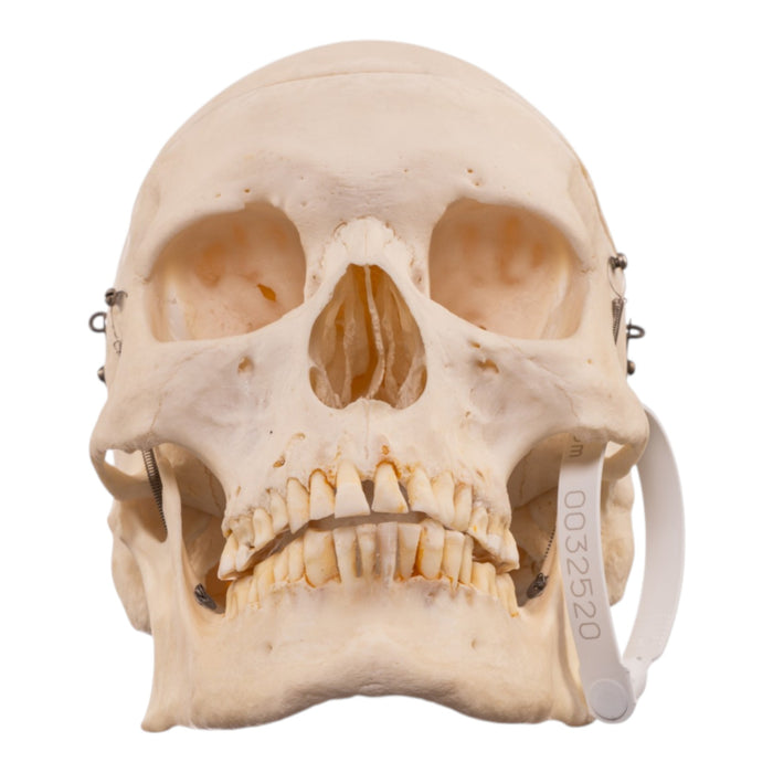 Real Human Skeleton - Disarticulated
