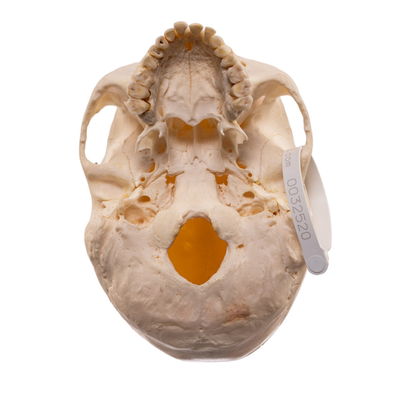 Real Human Skeleton - Disarticulated